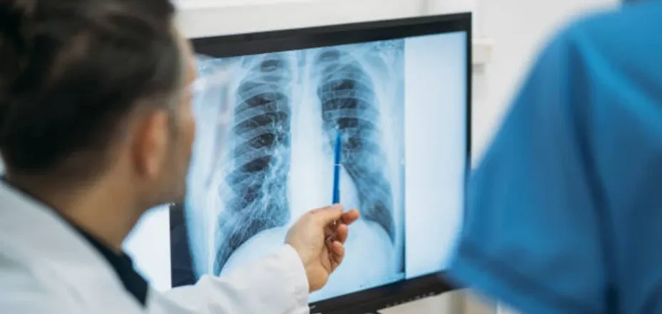 ідіопатичний легеневий фіброз