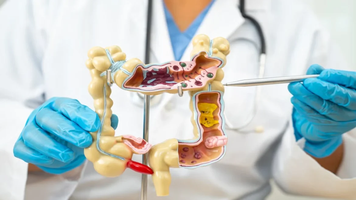 виразковий коліт: шлях до стійкої ремісії